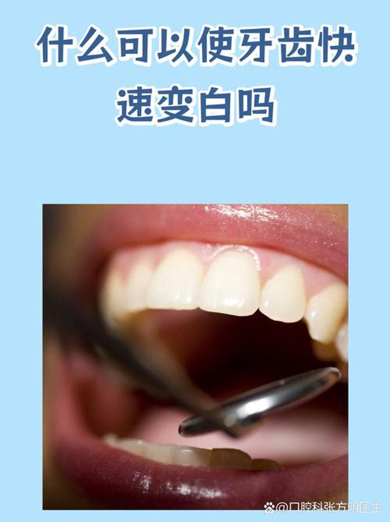 种牙指南：选择种植牙的正确打开方式