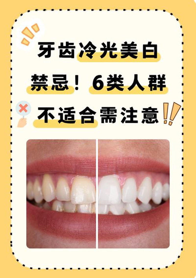 牙齿美白