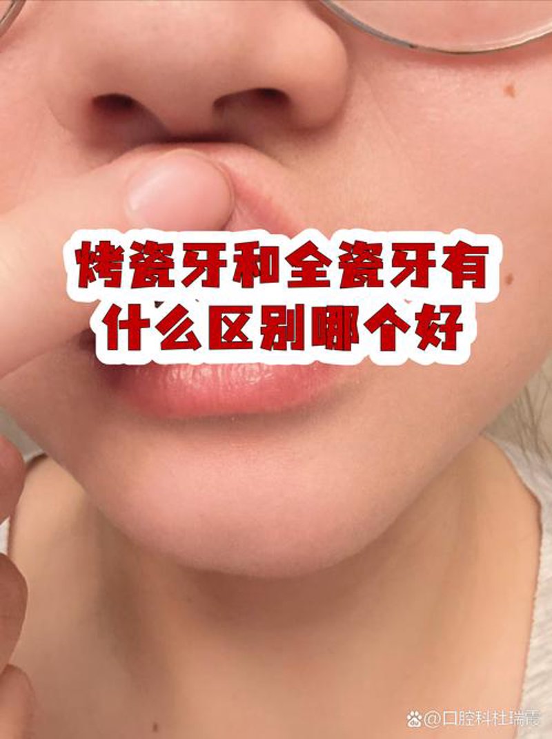 牙齿矫正：如何巧妙选择矫正方法