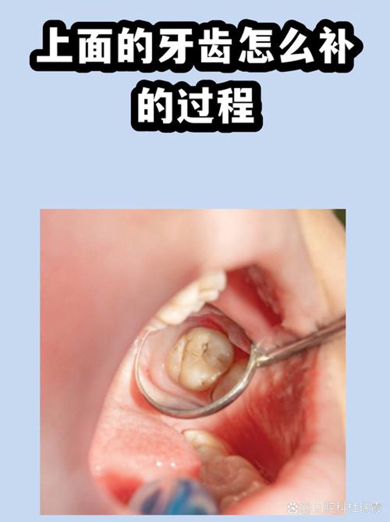 牙齿矫正：一场微笑革命的兴起