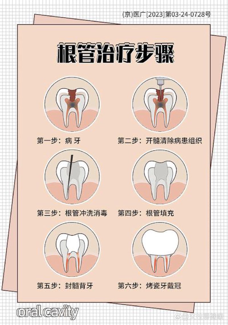 牙齿矫正新趋势：从传统到隐形