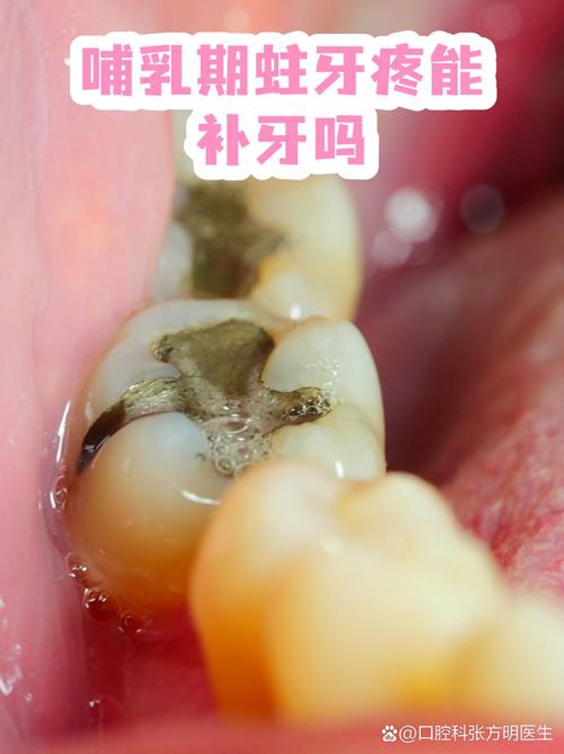 种植牙技术的发展与未来