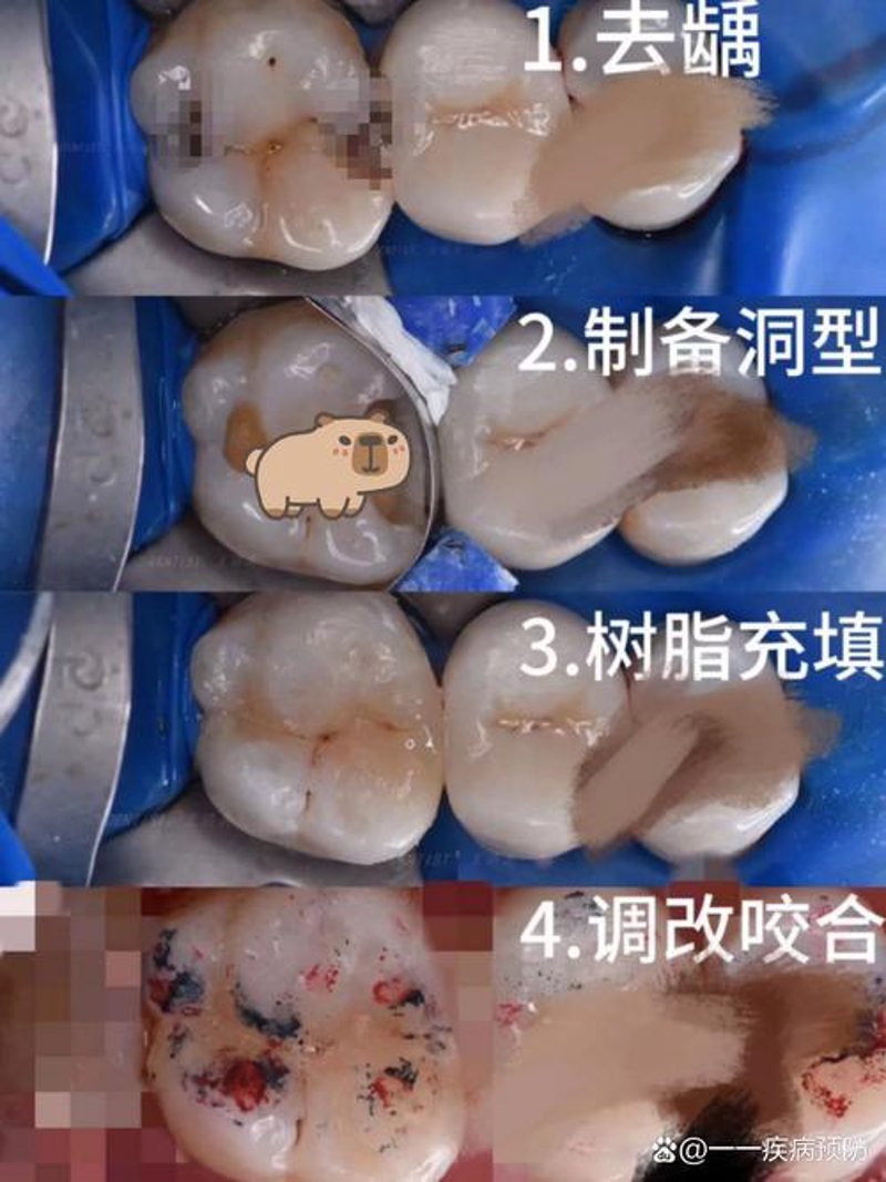 隐形矫正：改变你我，重塑美好