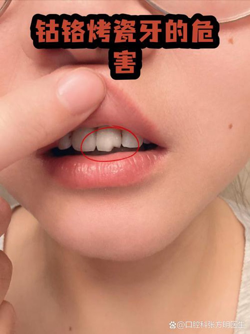 隐形矫正，轻松拥有迷人微笑的秘密武器