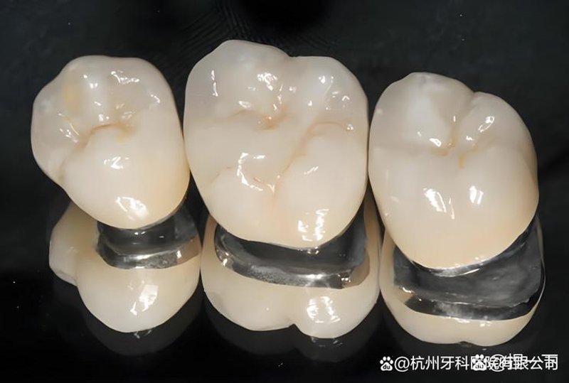 烤瓷牙